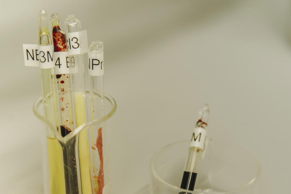 Der Europäische Forschungsrat und die Deutsche Forschungsgemeinschaft unterstützen die Fluor-Forschung an der Freien Universität mit zwei hochdotierten Förderungen: einem ERC Consolidator Grant und einem Sonderforschungsbereich.