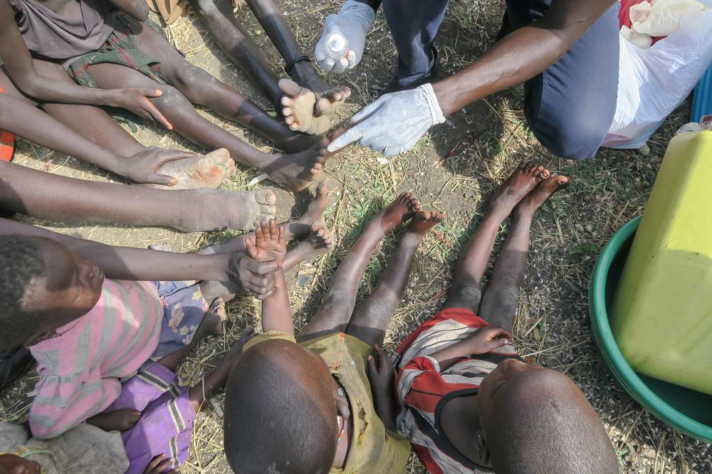 Einfach zu behandeln. Gegen den Sandfloh lässt sich Silikonöl wirkungsvoll einsetzen. Die Beschwerden klingen nach dem Bestreichen der betroffenen Stellen mit dem Öl rasch ab.